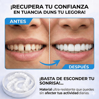 Dientes Moldables Smile: Carillas Provisionales para una Sonrisa Perfecta al Instante