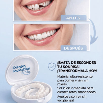 Dientes Moldables Smile: Carillas Provisionales para una Sonrisa Perfecta al Instante