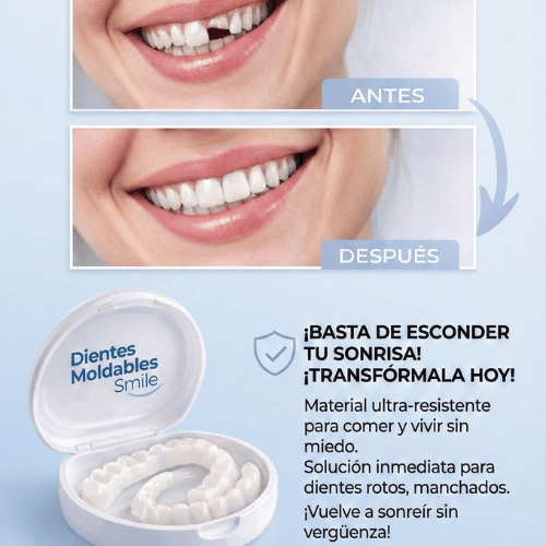 Dientes Moldables Smile: Carillas Provisionales para una Sonrisa Perfecta al Instante