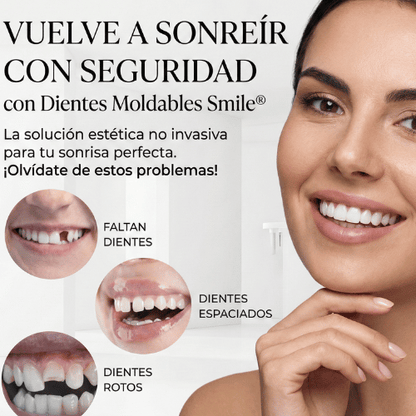Dientes Moldables Smile: Carillas Provisionales para una Sonrisa Perfecta al Instante