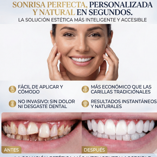 Dientes Moldables Smile: Carillas Provisionales para una Sonrisa Perfecta al Instante